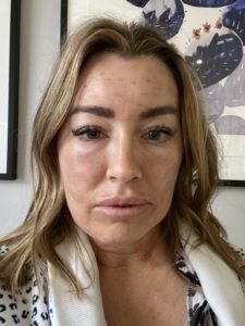 factora for anti-aging before and after results worst day 3